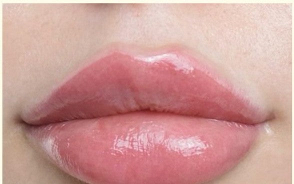 Lips treated with MED-X